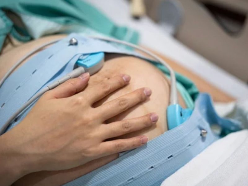 Fotos web - registro cardiotocográfico